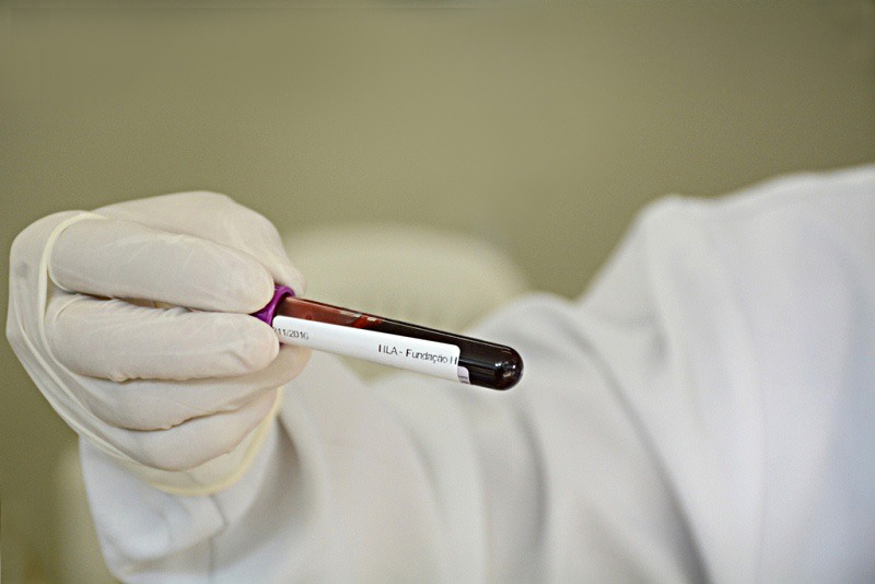 Governo de Minas passa a disponibilizar resultados de exames dos doadores de sangue no MG App